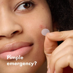 Mighty Patch™ from Hero Cosmetics - Hydrocolloid Acne Pimple Patch for Covering Zits and Blemishes