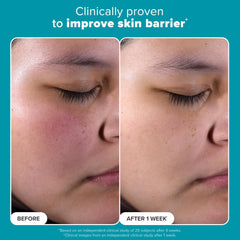 Paula's Choice SKIN PERFECTING 2% BHA Liquid Salicylic Acid Exfoliant-Facial Exfoliant for Enlarged Pores